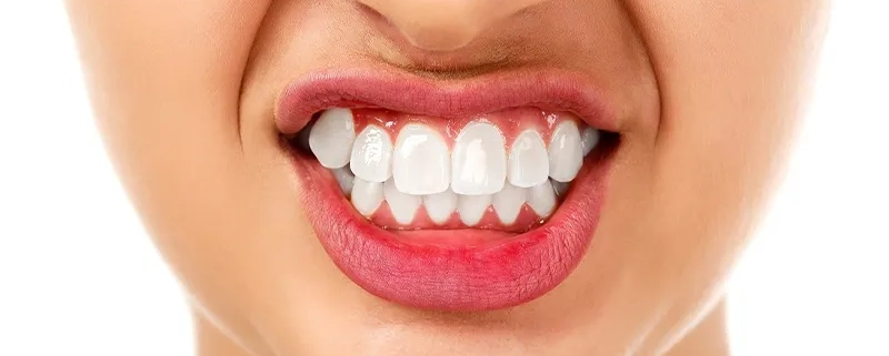 علل و درمان دندان قروچه (براکسیسم)